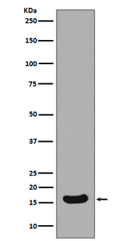 Survivin Rabbit mAb Antibody