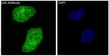 p38 MAPK Rabbit mAb [KD Validated] Antibody