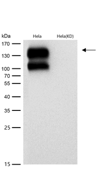 Integrin beta 1 Rabbit mAb [KD Validated]