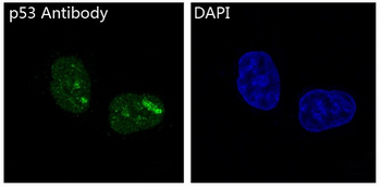 p53 Rabbit mAb Antibody
