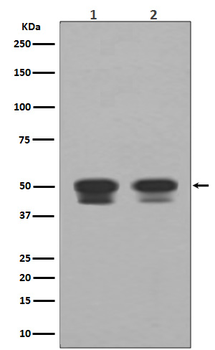 p53 Rabbit mAb Antibody