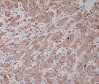 Tubulin gamma Rabbit mAb [KD Validated] Antibody