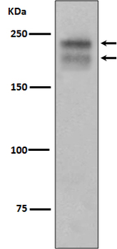VEGF Receptor 2 Rabbit mAb Antibody