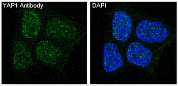 YAP1 Rabbit mAb Antibody