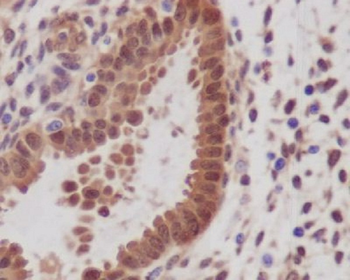 YAP1 Rabbit mAb Antibody
