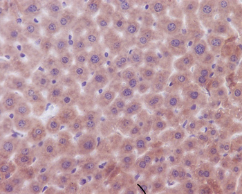Bak Rabbit mAb Antibody