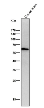 ELK1 Rabbit mAb Antibody
