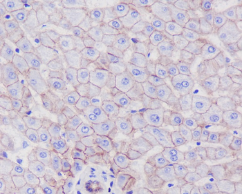 SCARB1 Rabbit Monoclonal Antibody