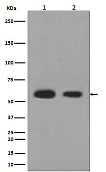Calreticulin Rabbit mAb [KD Validated]