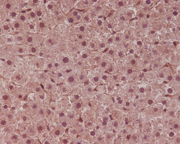 STAT6 Rabbit mAb