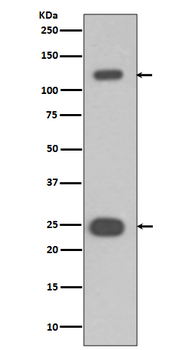 PARP Rabbit mAb Antibody