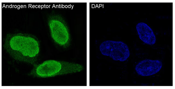Androgen Receptor Rabbit mAb [KD Validated] Antibody