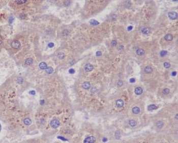 Glutamine Synthetase Rabbit mAb   [KD Validated]