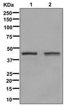 Glutamine Synthetase Rabbit mAb   [KD Validated]