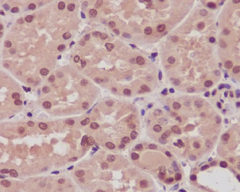 ARRB1 Rabbit mAb [KD Validated] Antibody