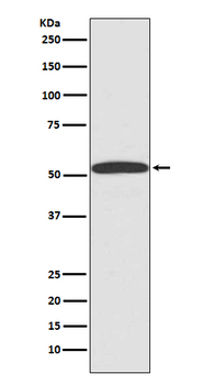ARRB1 Rabbit mAb [KD Validated] Antibody
