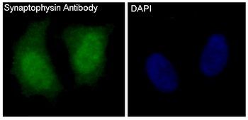 Synaptophysin Rabbit Monoclonal Antibody