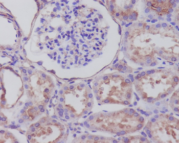 Synaptophysin Rabbit Monoclonal Antibody