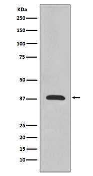 Synaptophysin Rabbit Monoclonal Antibody