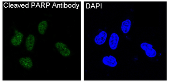 Cleaved PARP Rabbit mAb Antibody