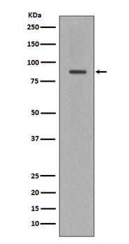 Cleaved PARP Rabbit mAb Antibody