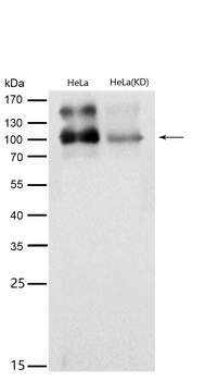 Amyloid beta A4 Rabbit mAb [KD Validated] Antibody