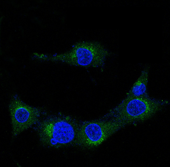 Amyloid beta A4 Rabbit mAb [KD Validated] Antibody