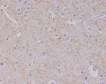 Amyloid beta A4 Rabbit mAb [KD Validated] Antibody
