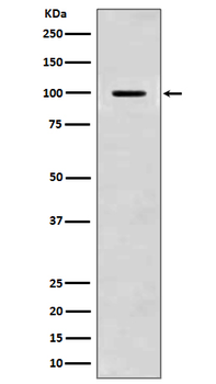 Amyloid beta A4 Rabbit mAb [KD Validated] Antibody