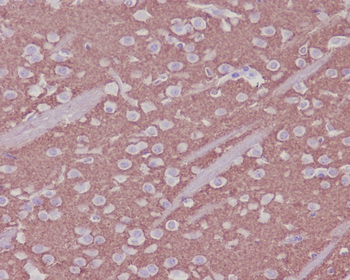 Synaptophysin Rabbit Monoclonal Antibody