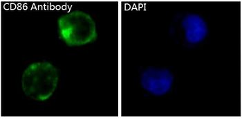 CD86 Rabbit mAb Antibody