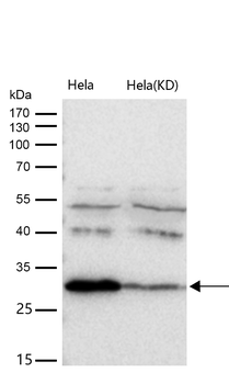 BDNF Rabbit mAb [KD Validated] Antibody