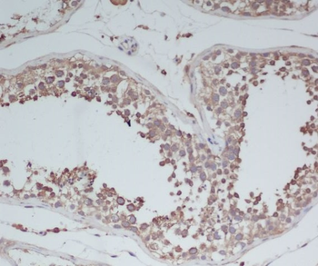 BDNF Rabbit mAb [KD Validated] Antibody