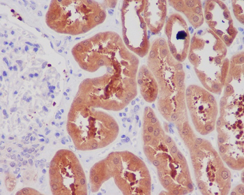 NGF Rabbit Monoclonal Antibody