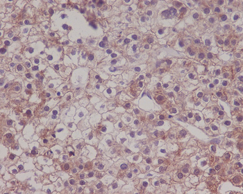 LRP1 Rabbit Monoclonal Antibody