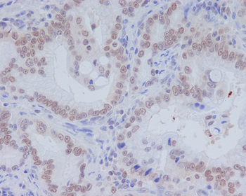 CD11b Rabbit Monoclonal Antibody
