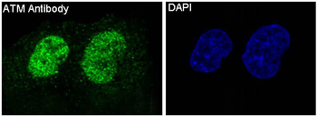 ATM Rabbit Monoclonal Antibody