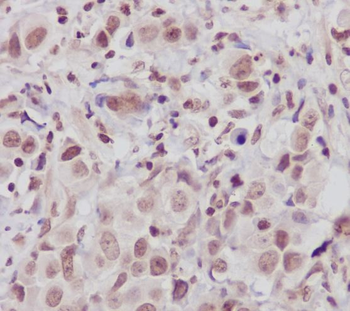 ATM Rabbit Monoclonal Antibody