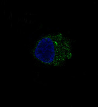 S100B Rabbit Monoclonal Antibody