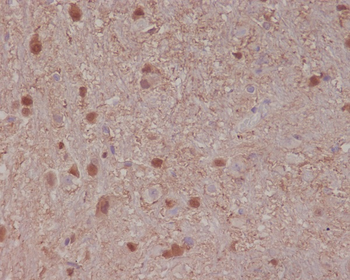 S100B Rabbit Monoclonal Antibody