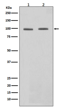 STAT6 Rabbit mAb