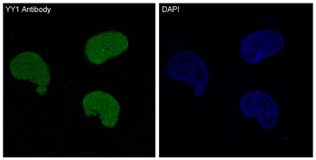 YY1 Rabbit Monoclonal Antibody