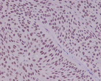 YY1 Rabbit Monoclonal Antibody