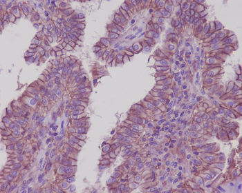 Sodium Potassium ATPase Rabbit Monoclonal Antibody