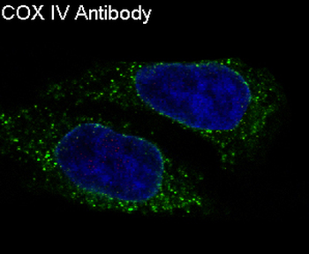 COX IV Rabbit mAb [KD Validated] Antibody
