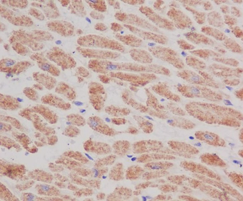 COX IV Rabbit mAb [KD Validated] Antibody