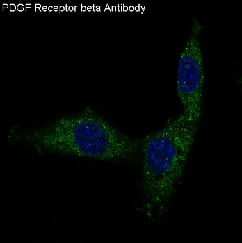 PDGF Receptor beta Rabbit Monoclonal Antibody
