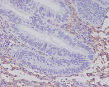 PDGF Receptor beta Rabbit Monoclonal Antibody