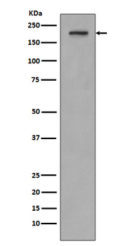 PDGF Receptor beta Rabbit Monoclonal Antibody