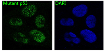 p53 Rabbit mAb Antibody